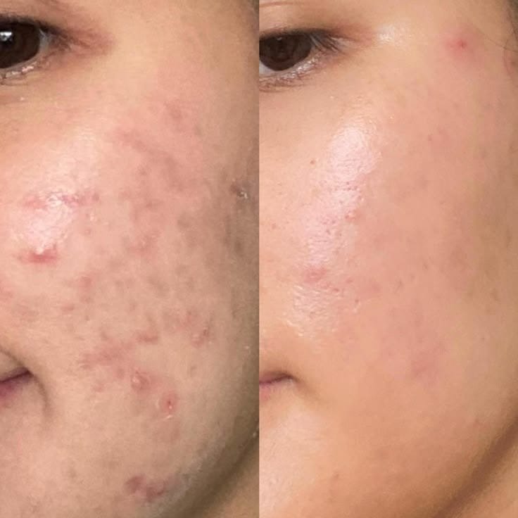 Skin Brightening Results
