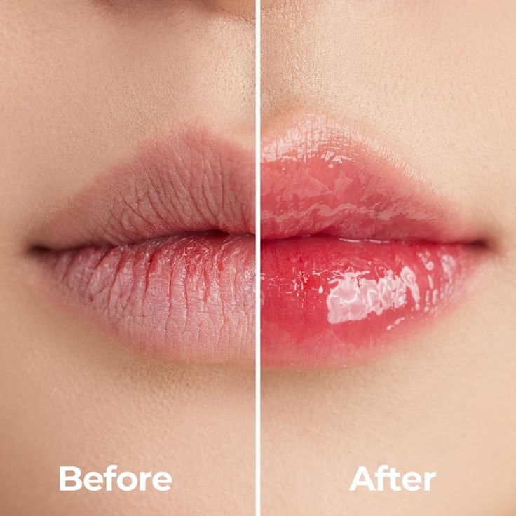Dark Spot Reduction Results